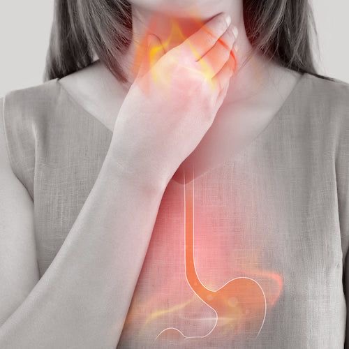 ANCAMAN GERD DI USIA MUDA: BAHAYA KEBIASAN LANGSUNG REBAHAN SETELAH MAKAN
